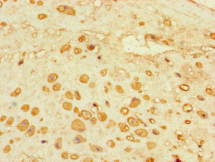 Immunohistochemistry of paraffin-embedded human placenta tissue using ADORA2A Antibody at dilution of 1:100Rabbit anti-Human ADORA2A Polyclonal Antibody