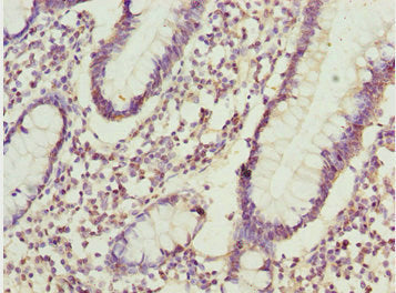 Immunohistochemistry of paraffin-embedded human small intestine tissue using ADPGK Antibody at dilution of 1:100Rabbit anti-Human ADPGK Polyclonal Antibody