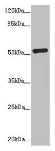 Western blot  | All lanes: ADPGK antibody at 1.02µg/ml + Hela whole cell lysate  | Secondary  | Goat polyclonal to rabbit IgG at 1/10000 dilution  | Predicted band size: 55, 54, 29, 25, 39, 9 kDa  | Observed band size: 54 kDa