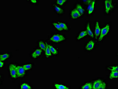 Immunofluorescent analysis of HepG2 cells using ADRB1 Antibody at dilution of 1:100 and Alexa Fluor 488-congugated AffiniPure Goat Anti-Rabbit IgG(H+L)Rabbit anti-Human ADRB1 Polyclonal Antibody