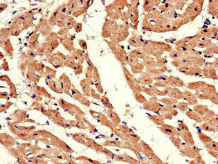 Immunohistochemistry of paraffin-embedded human heart tissue using ADRB1 Antibody at dilution of 1:100Rabbit anti-Human ADRB1 Polyclonal Antibody
