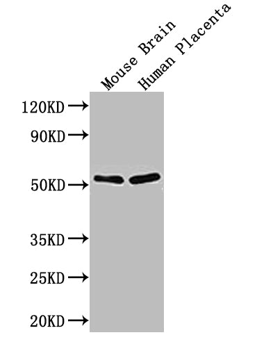 Western Blot Positive WB detected in:Mouse Brain tissue lysate,Human Placenta tissue lysate All lanes: ADRB1 antibody at 1:1000 Secondary Goat polyclonal to rabbit IgG at 1/50000 dilution Predicted band size: 52 kDa Observed band size: 52 kDa