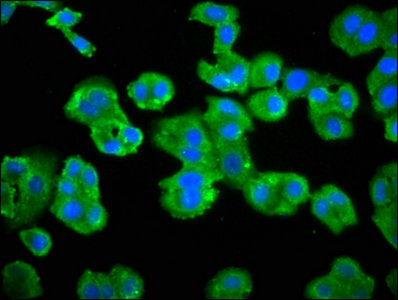 Immunofluorescence staining of HepG2 cells with GRK3 Antibody at 1:66, counter-stained with DAPI. The cells were fixed in 4% formaldehyde, permeabilized using 0.2% Triton X-100 and blocked in 10% normal Goat Serum. The cells were then incubated with the antibody overnight at 4°C. The secondary antibody was Alexa Fluor 488-congugated AffiniPure Goat Anti-Rabbit IgG(H+L).Rabbit anti-Human GRK3 Polyclonal Antibody