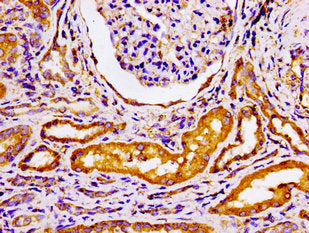 Immunohistochemistry of paraffin-embedded human kidney tissue using GRK3 Antibody at dilution of 1:100Rabbit anti-Human GRK3 Polyclonal Antibody