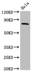 Western Blot | Positive WB detected in: Hela whole cell lysate | All lanes: GRK3 antibody at 2μg/ml | Secondary | Goat polyclonal to rabbit IgG at 1/50000 dilution | Predicted band size: 80 kDa | Observed band size: 80 kDaRabbit anti-Human GRK3 Polyclonal Antibody
