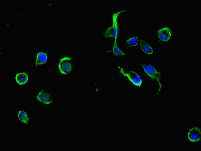 Immunofluorescent analysis of MCF-7 cells using ADRM1 Antibody at dilution of 1:100 and Alexa Fluor 488-congugated AffiniPure Goat Anti-Rabbit IgG(H+L)Rabbit anti-Human ADRM1 Polyclonal Antibody