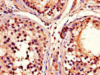 Immunohistochemistry of paraffin-embedded human testis tissue using ADRM1 Antibody at dilution of 1:100Rabbit anti-Human ADRM1 Polyclonal Antibody
