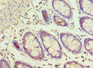 Immunohistochemistry of paraffin-embedded human colon tissue using ADSS Antibody at dilution of 1:100Rabbit anti-Human ADSS Polyclonal Antibody