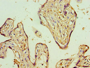 Immunohistochemistry of paraffin-embedded human placenta tissue using ADSS Antibody at dilution of 1:100Rabbit anti-Human ADSS Polyclonal Antibody