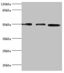 Western blot | All lanes: Adenylosuccinate synthetase isozyme 2 antibody at 12μg/ml | Lane 1: Mouse skeletal muscle tissue | Lane 2: HepG2 whole cell lysate | Lane 3: K562 whole cell lysate | Secondary | Goat polyclonal to rabbit IgG at 1/10000 dilution | Predicted band size: 50 kDa | Observed band size: 50 kDa