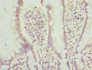 Immunohistochemistry of paraffin-embedded human small intestine tissue using AGPAT2 Antibody at dilution of 1:100Rabbit anti-Human AGPAT2 Polyclonal Antibody