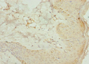 Immunohistochemistry of paraffin-embedded human skin tissue using AGPAT2 Antibody at dilution of 1:100Rabbit anti-Human AGPAT2 Polyclonal Antibody