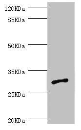 Western blot | All lanes: AGPAT2 antibody at 1.09μg/ml + Jurkat whole cell lysate | Secondary | Goat polyclonal to rabbit IgG at 1/10000 dilution | Predicted band size: 31, 28 kDa | Observed band size: 31 kDaRabbit anti-Human AGPAT2 Polyclonal Antibody
