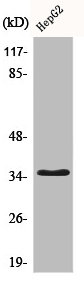 Western Blot analysis of HepG2 cells using CD34 Polyclonal AntibodyRabbit anti-Human CD34 Polyclonal Antibody