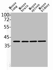 mouse-lung mouse-brain mouse-spleen mouse-kidneyRabbit anti-Human CD34 Polyclonal Antibody