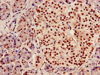 Immunohistochemistry of paraffin-embedded human pancreatic tissue using AGPAT5 Antibody at dilution of 1:100Rabbit anti-Human AGPAT5 Polyclonal Antibody