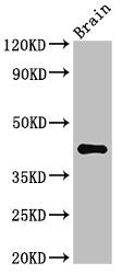 Western Blot | Positive WB detected in: Mouse brain tissue | All lanes: AGPAT5 antibody at 3.4μg/ml | Secondary | Goat polyclonal to rabbit IgG at 1/50000 dilution | Predicted band size: 43 kDa | Observed band size: 43 kDaRabbit anti-Human AGPAT5 Polyclonal Antibody