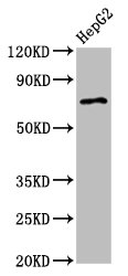 Western Blot  | Positive WB detected in: HepG2 whole cell lysate  | All lanes: AGPS antibody at 2.7µg/ml  | Secondary  | Goat polyclonal to rabbit IgG at 1/50000 dilution  | Predicted band size: 73 kDa  | Observed band size: 73 kDaRabbit anti-Human AGPS Polyclonal Antibody
