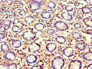 Immunohistochemistry of paraffin-embedded human small intestine tissue using AGR2 Antibody at dilution of 1:100Rabbit anti-Human AGR2 Polyclonal Antibody