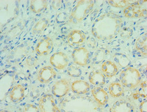 Immunohistochemistry of paraffin-embedded human kidney tissue using AGR2 Antibody at dilution of 1:100Rabbit anti-Human AGR2 Polyclonal Antibody