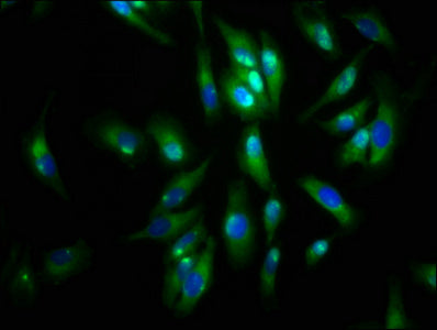 Immunofluorescence staining of Hela cells with the antibody at 1:133, counter-stained with DAPI. The cells were fixed in 4% formaldehyde, permeabilized using 0.2% Triton X-100 and blocked in 10% normal Goat Serum. The cells were then incubated with the antibody overnight at 4°C. The secondary antibody was Alexa Fluor 488-congugated AffiniPure Goat Anti-Rabbit IgG(H+L).Rabbit anti-Human AGRN Polyclonal Antibody