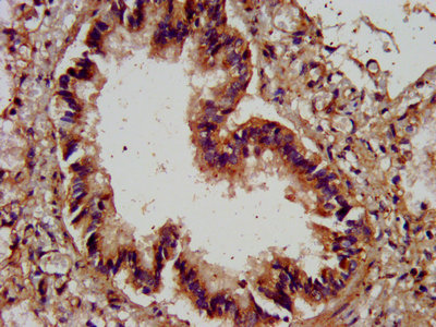 IHC image of AGRN Antibody diluted at 1:400 and staining in paraffin-embedded human lung tissue performed on a Leica BondTM system. After dewaxing and hydration, antigen retrieval was mediated by high pressure in a citrate buffer (pH 6.0). Section was blocked with 10% normal goat serum 30min at RT. Then primary antibody (1% BSA) was incubated at 4°C overnight. The primary is detected by a biotinylated secondary antibody and visualized using an HRP conjugated SP system.Rabbit anti-Human AGRN Polyclonal Antibody