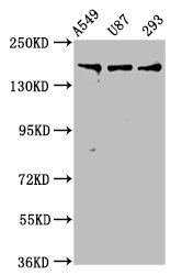 Western Blot  | Positive WB detected in: A549 whole cell lysate, U87 whole cell lysate, 293 whole cell lysate  | All lanes: AGRN antibody at 7.5μg/ml  | Secondary  | Goat polyclonal to rabbit IgG at 1/50000 dilution  | Predicted band size: 218, 206, 217, 215 kDa  | Observed band size: 218 kDaRabbit anti-Human AGRN Polyclonal Antibody