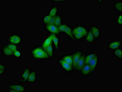 Immunofluorescent analysis of HepG2 cells using AGT Antibody at dilution of 1:100 and Alexa Fluor 488-congugated AffiniPure Goat Anti-Rabbit IgG(H+L)Rabbit anti-Human AGT Polyclonal Antibody