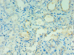 Immunohistochemistry of paraffin-embedded human kidney tissue using AGT Antibody at dilution of 1:100Rabbit anti-Human AGT Polyclonal Antibody