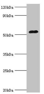 Western blot | All lanes: Angiotensinogen antibody at 3μg/ml + Mouse liver tissue | Secondary | Goat polyclonal to rabbit IgG at 1/10000 dilution | Predicted band size: 53 kDa | Observed band size: 53 kDaRabbit anti-Human AGT Polyclonal Antibody