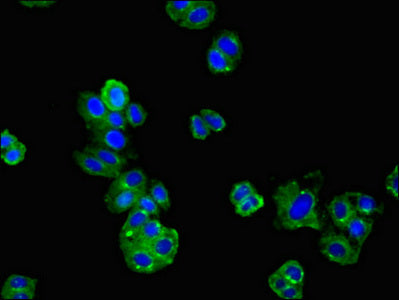 Immunofluorescent analysis of HepG2 cells using AGTR1 Antibody at dilution of 1:100 and Alexa Fluor 488-congugated AffiniPure Goat Anti-Rabbit IgG(H+L)Rabbit anti-Human AGTR1 Polyclonal Antibody