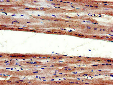 Immunohistochemistry of paraffin-embedded human heart tissue using AGTR1 Antibody at dilution of 1:100Rabbit anti-Human AGTR1 Polyclonal Antibody