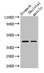 Western Blot | Positive WB detected in: Mouse stomach tissue, Mouse skeletal muscle tissue | All lanes: AGTR1 antibody at 3μg/ml | Secondary | Goat polyclonal to rabbit IgG at 1/50000 dilution | Predicted band size: 42 kDa | Observed band size: 42 kDaRabbit anti-Human AGTR1 Polyclonal Antibody