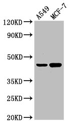 Western Blot  | Positive WB detected in: A549 whole cell lysate, MCF-7 whole cell lysate  | All lanes: AGXT antibody at 3µg/ml  | Secondary  | Goat polyclonal to rabbit IgG at 1/50000 dilution  | Predicted band size: 44 kDa  | Observed band size: 44 kDaRabbit anti-Human AGXT Polyclonal Antibody