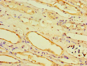 Immunohistochemistry of paraffin-embedded human kidney tissue using AHCYL1 Antibody at dilution of 1:100