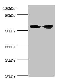 Western blot | All lanes: AHCYL1 antibody at 12μg/ml | Lane 1: Hela whole cell lysate | Lane 2: 293T whole cell lysate | Secondary | Goat polyclonal to rabbit IgG at 1/10000 dilution | Predicted band size: 59, 54 kDa | Observed band size: 59 kDa