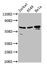Western Blot  | Positive WB detected in: Jurkat whole cell lysate, A549 whole cell lysate, Hela whole cell lysate  | All lanes: AIFM1 antibody at 2.8µg/ml  | Secondary  | Goat polyclonal to rabbit IgG at 1/50000 dilution  | Predicted band size: 67, 36, 29, 27 kDa  | Observed band size: 67 kDaRabbit anti-Human AIFM1 Polyclonal Antibody