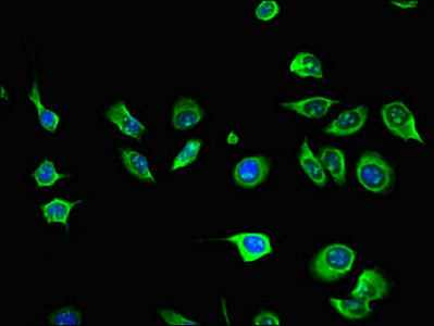 Immunofluorescent analysis of A549 cells using AIM2 Antibody at dilution of 1:100 and Alexa Fluor 488-congugated AffiniPure Goat Anti-Rabbit IgG(H+L)Rabbit anti-Human AIM2 Polyclonal Antibody