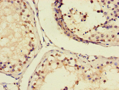 Immunohistochemistry of paraffin-embedded human testis tissue using AIM2 Antibody at dilution of 1:100Rabbit anti-Human AIM2 Polyclonal Antibody