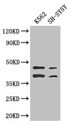 Western Blot | Positive WB detected in: K562 whole cell lysate, SH-SY5Y whole cell lysate | All lanes: AIM2 antibody at 2.7μg/ml | Secondary | Goat polyclonal to rabbit IgG at 1/50000 dilution | Predicted band size: 39 kDa | Observed band size: 39, 45 kDaRabbit anti-Human AIM2 Polyclonal Antibody