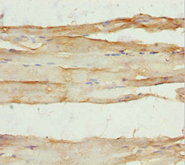 Immunohistochemistry of paraffin-embedded human skeletal muscle tissue using AK1 Antibody at dilution of 1:100Rabbit anti-Human AK1 Polyclonal Antibody