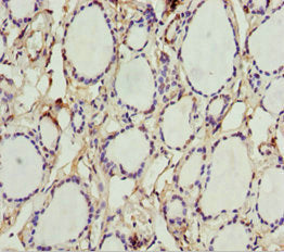 Immunohistochemistry of paraffin-embedded human thyroid tissue using AK1 Antibody at dilution of 1:100Rabbit anti-Human AK1 Polyclonal Antibody