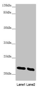 Western blot | All lanes: AK1 antibody at 0.51 μg/ml | Lane 1: Mouse skeletal muscle tissue | Lane 2: Mouse heart tissue | Secondary | Goat polyclonal to rabbit IgG at 1/10000 dilution | Predicted band size: 22 kDa | Observed band size: 22 kDaRabbit anti-Human AK1 Polyclonal Antibody