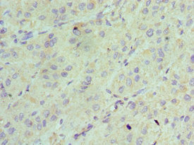 Immunohistochemistry of paraffin-embedded human liver tissue using AK2 Antibody at dilution of 1:100Rabbit anti-Human AK2 Polyclonal Antibody