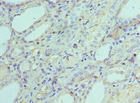 Immunohistochemistry of paraffin-embedded human kidney tissue using AK2 Antibody at dilution of 1:100Rabbit anti-Human AK2 Polyclonal Antibody