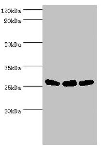 Western blot | All lanes: Adenylate kinase 2, mitochondrial antibody at 5μg/ml | Lane 1: Hela whole cell lysate | Lane 2: Mouse kidney tissue | Lane 3: Mouse small intestine tissue | Secondary | Goat polyclonal to rabbit IgG at 1/10000 dilution | Predicted band size: 27, 26, 23, 15, 25, 22 kDa | Observed band size: 27 kDaRabbit anti-Human AK2 Polyclonal Antibody