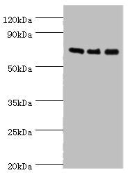 Western blot | All lanes: AKAP10 antibody at 7μg/ml | Lane 1: 293T whole cell lysate | Lane 2: Hela whole cell lysate | Lane 3: HepG2 whole cell lysate | Secondary | Goat polyclonal to rabbit IgG at 1/10000 dilution | Predicted band size: 74 kDa | Observed band size: 74 kDaRabbit anti-Human AKAP10 Polyclonal Antibody