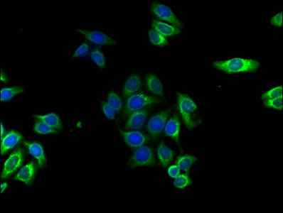 Immunofluorescence staining of HepG2 cells with AKAP7 Antibody at 1:120,counter-stained with DAPI. The cells were fixed in 4% formaldehyde, permeabilized using 0.2% Triton X-100 and blocked in 10% normal Goat Serum. The cells were then incubated with the antibody overnight at 4°C.The secondary antibody was Alexa Fluor 488-congugated AffiniPure Goat Anti-Rabbit IgG (H+L).Rabbit anti-Human AKAP7 Polyclonal Antibody