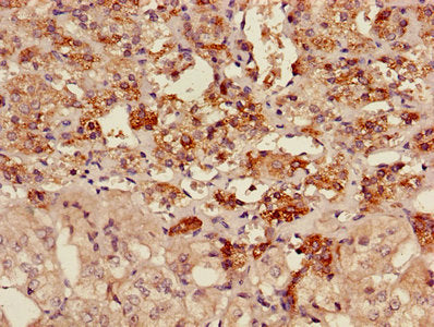 Immunohistochemistry of paraffin-embedded human adrenal gland tissue using the antibody at dilution of 1:100Rabbit anti-Human AKAP7 Polyclonal Antibody