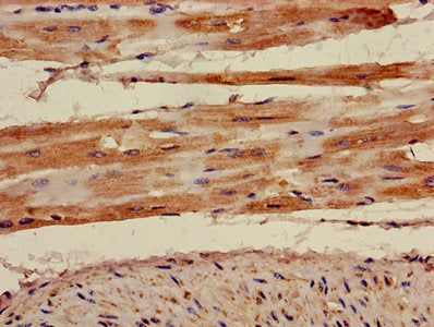 Immunohistochemistry of paraffin-embedded human heart tissue using AKAP7 Antibody at dilution of 1:100Rabbit anti-Human AKAP7 Polyclonal Antibody